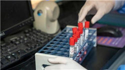 鲍威尔预告货币政策框架调整方向 警告未来通胀波动性恐持续高企